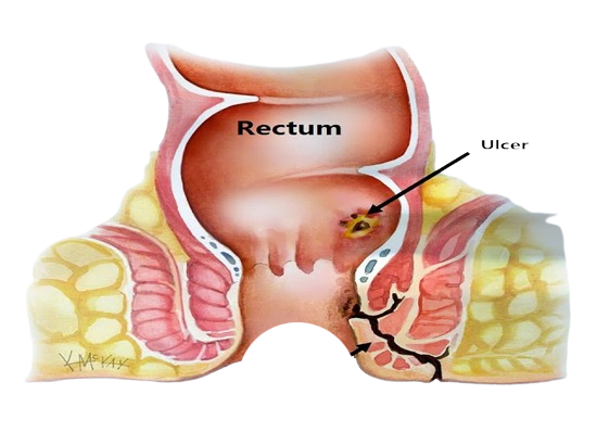 Digestive