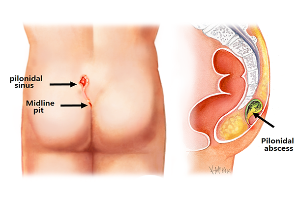 Digestive